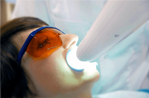 Understanding the Causes of Teeth Sensitivity Bracknell