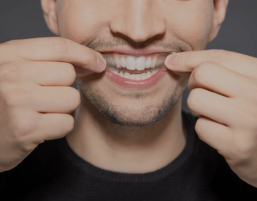 Can You Whiten Natural Teeth Without Harsh Chemicals Bracknell?