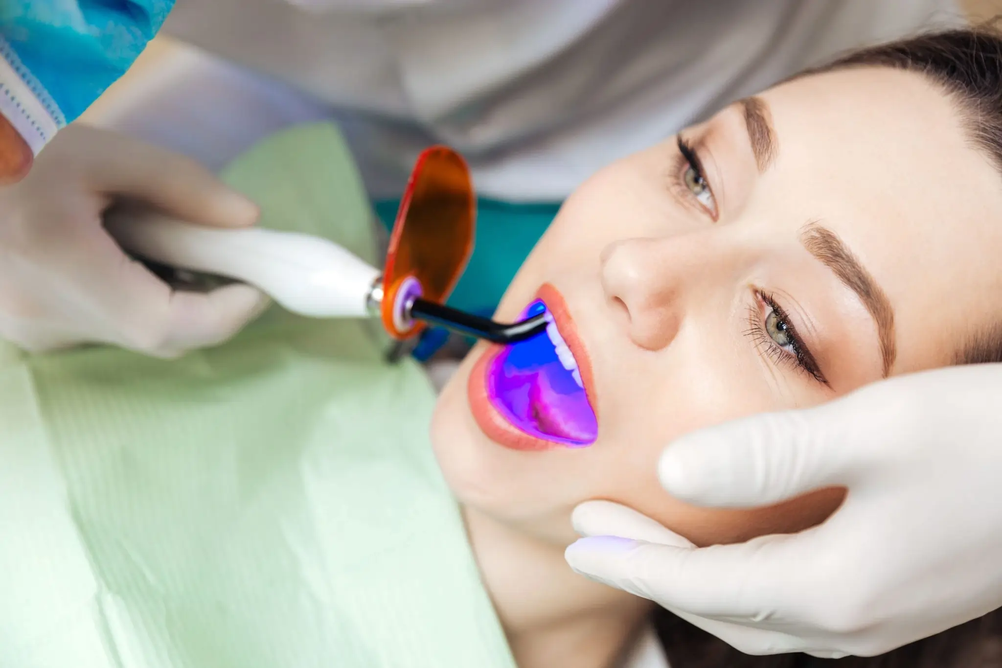How Long Can You Expect Laser Teeth Whitening Results to Last Bracknell?