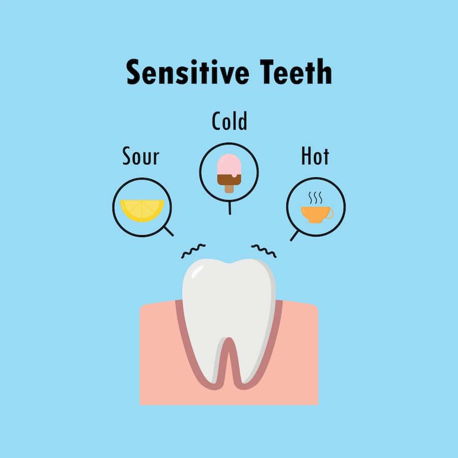 How Can You Tell If Your Teeth Are Becoming Sensitive Bracknell?