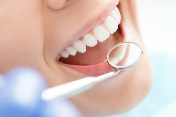 How to Maintain Your Whiter Smile After Treatment Bracknell
