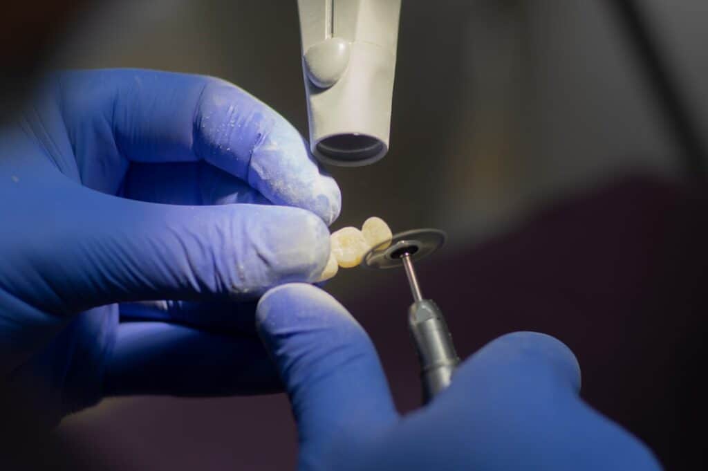 Customised Dental Solutions: Crowns, Aligners, and Implants Bracknell