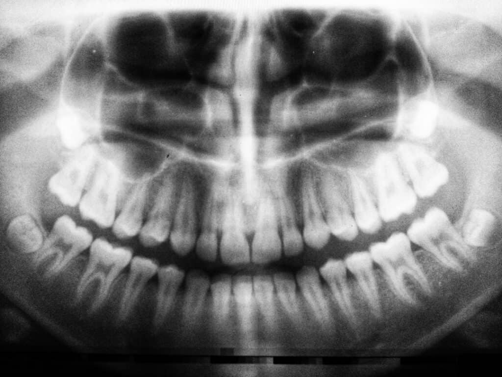The Future of 3D Printing in Oral Healthcare Bracknell